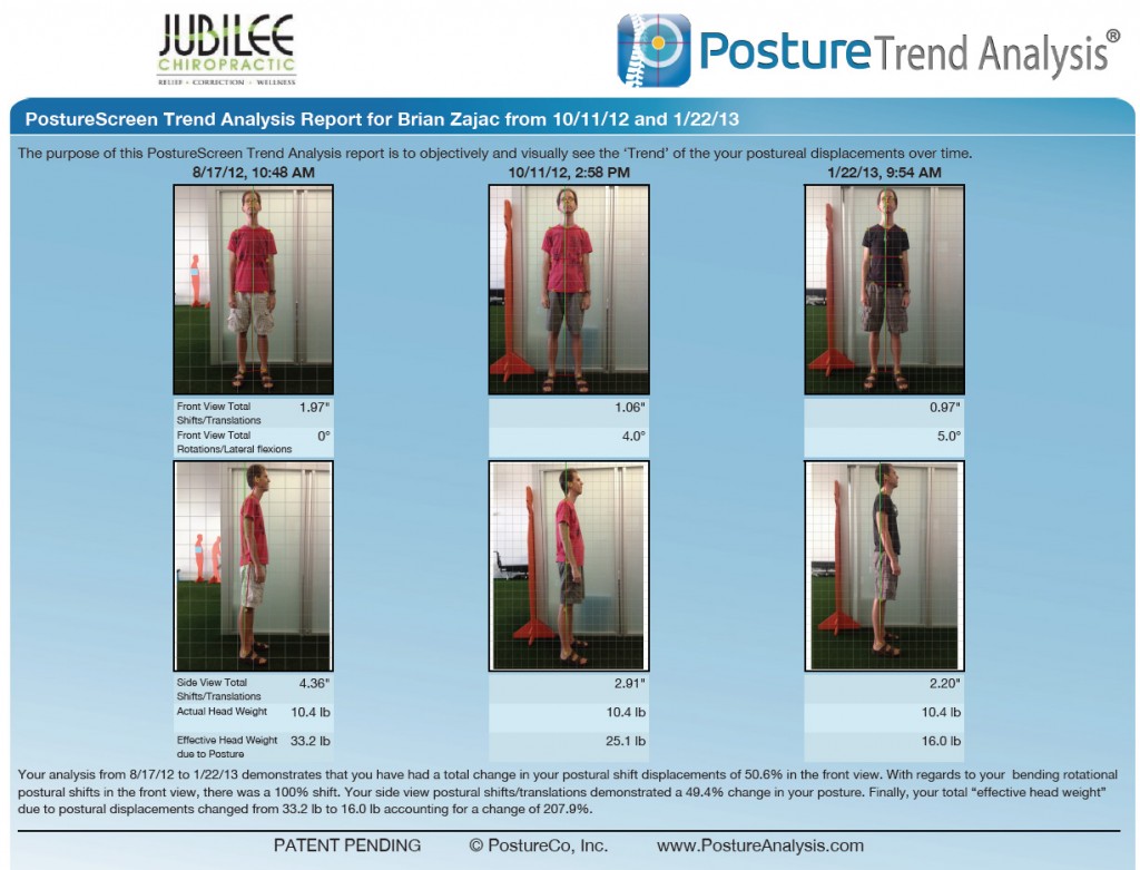 Chiropractic Posture 5-Month Analysis 